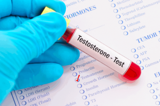 Ảnh hưởng của Testosterone đến tình trạng rối loạn cương dương